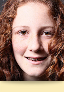 stock photo of a girl with braces