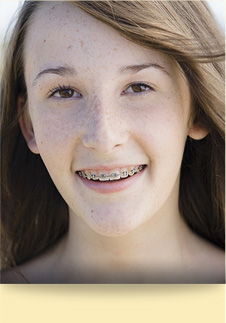 stock photo of a teen girl with braces
